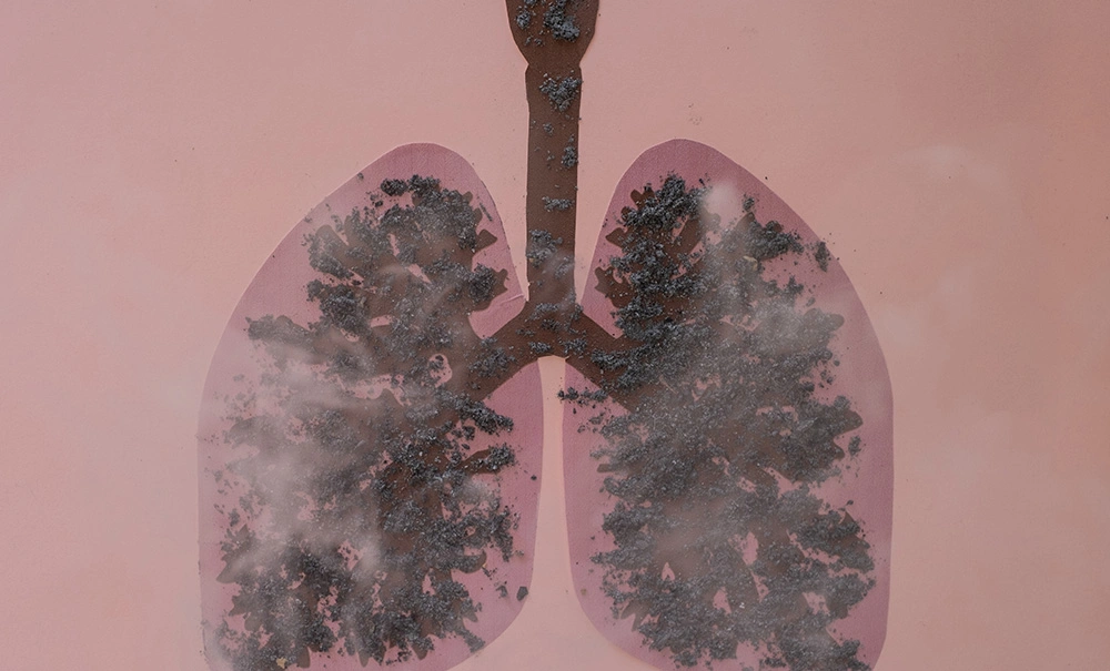 respiratory_medicine